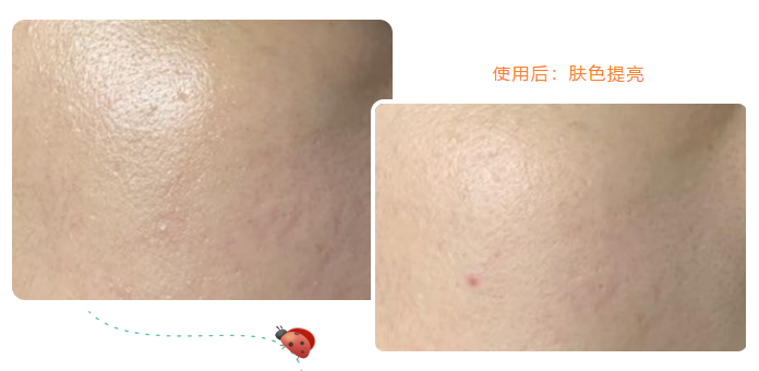 一氧化氮的作用与功效 贝妮芙产品中的NO作用